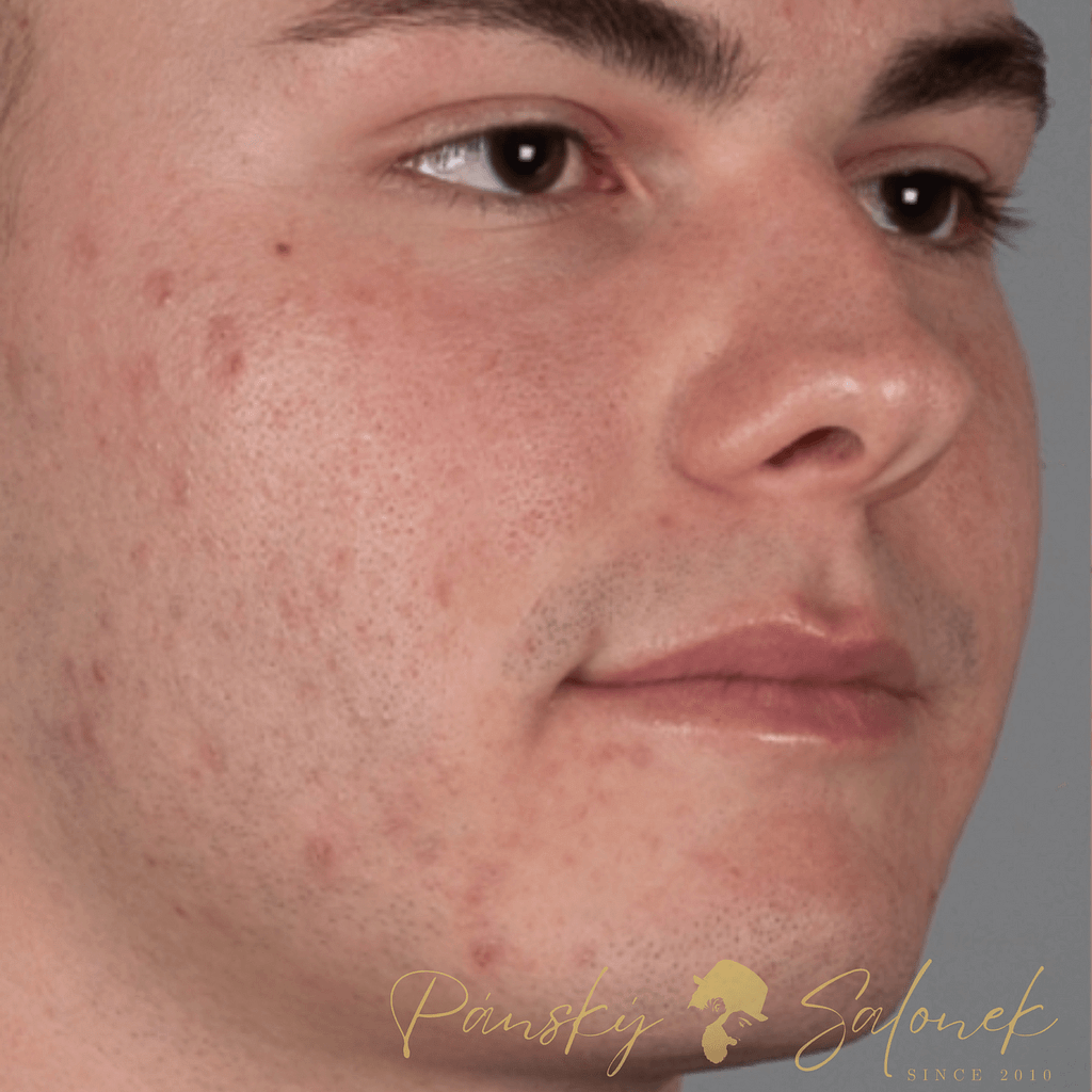 Před